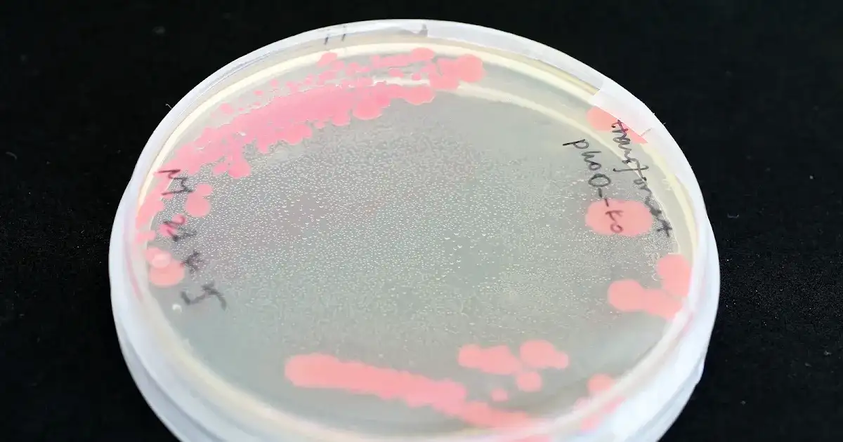 Sequential antibiotic strategy can weaken dangerous pathogens - 1