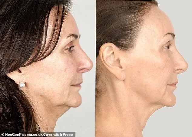 Shirley Ballas, 65, reveals the secrets to her ageless looks as she undergoes a day of intense skin treatments and tweakments in time for her major new TV show - 2