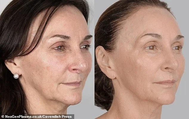 Shirley Ballas, 65, reveals the secrets to her ageless looks as she undergoes a day of intense skin treatments and tweakments in time for her major new TV show - 3