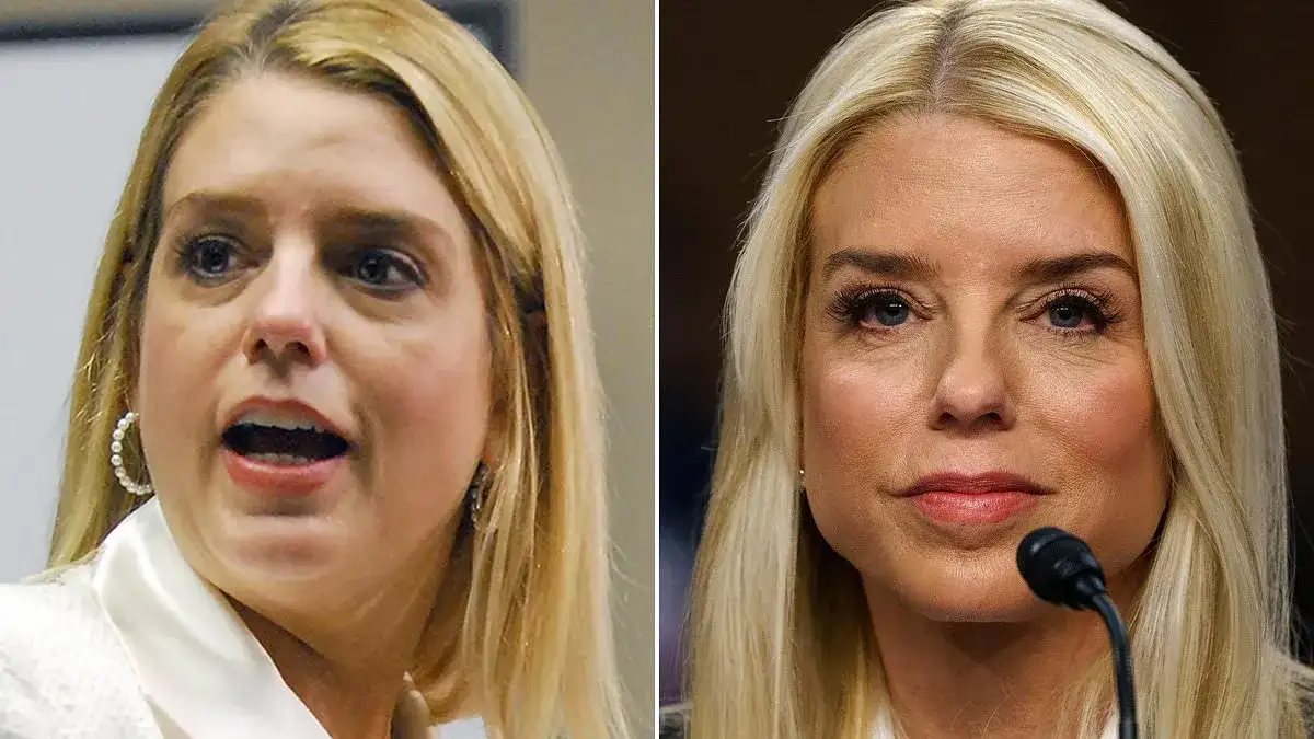 Pam Bondi Plastic Surgery Rumours: Experts Reveal Secrets Behind AG's 'Reverse Ageing' Face - 3