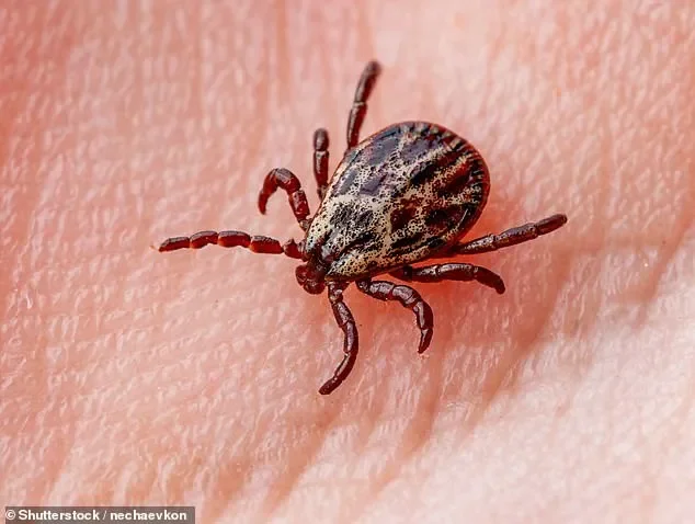 Jeremy, 16, died from a tick-induced meat allergy. Sydney’s north is a global hotspot for the disease - 2