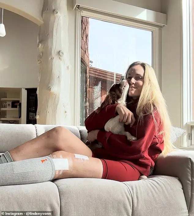Lindsey Vonn pushes through pain in inspiring recovery video after Olympic setback - 1