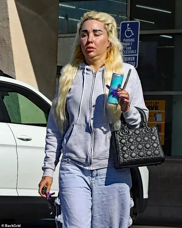 Amanda Bynes Looking Good on Solo Coffee Run Amid Weight Loss Effort - 2