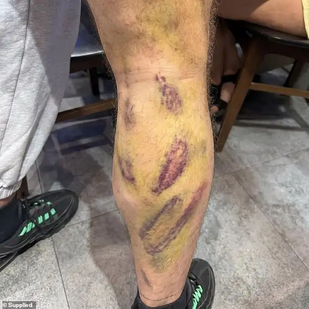 'Women Are So Out of Touch': Clavicular Livid After Hearing His GF Say She Could Get 50 Bodies in a Year - 1