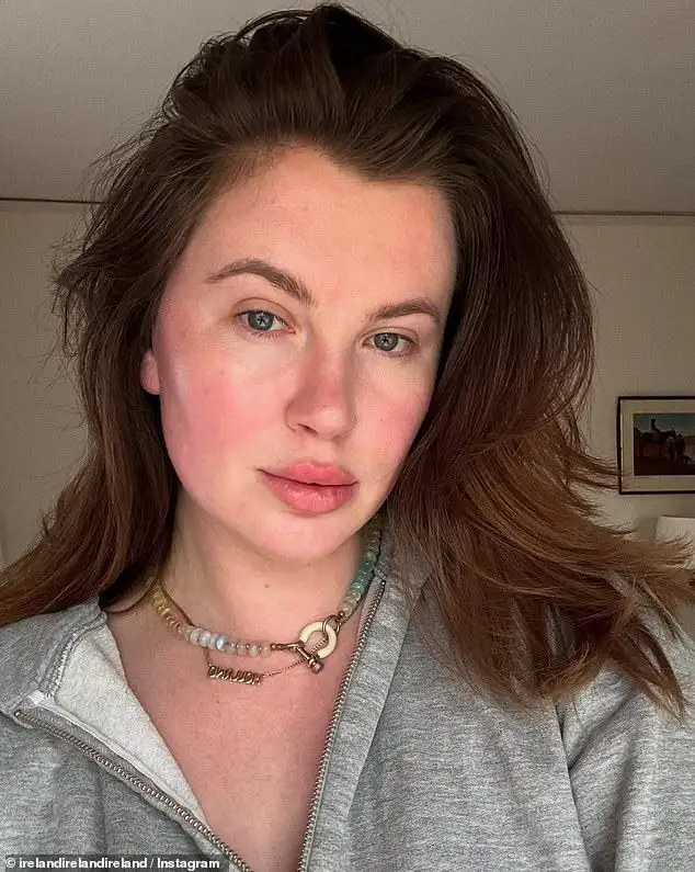Ireland Baldwin has another baby on the way! Alec Baldwin's daughter announces she is expecting second child with partner RAC - 3