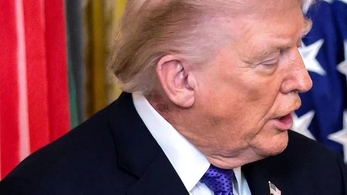 Trump's Third Walter Reed Visit in a Year Comes as His Doctor Stays Silent on Several Visible Symptoms - 1