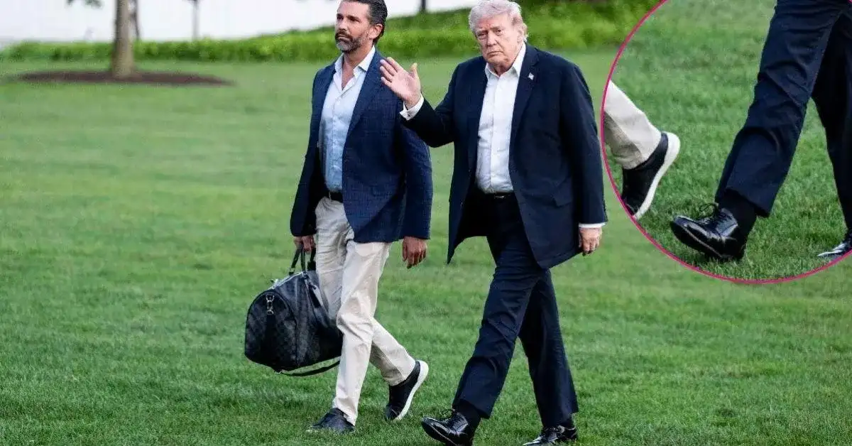 Donald Trump Health Fears: Viral 'Cankles' Video Sparks Concerns POTUS Is In Pain - 2