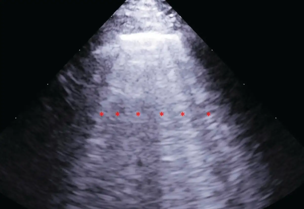 Can human heart failure interventions work in dogs? - 1