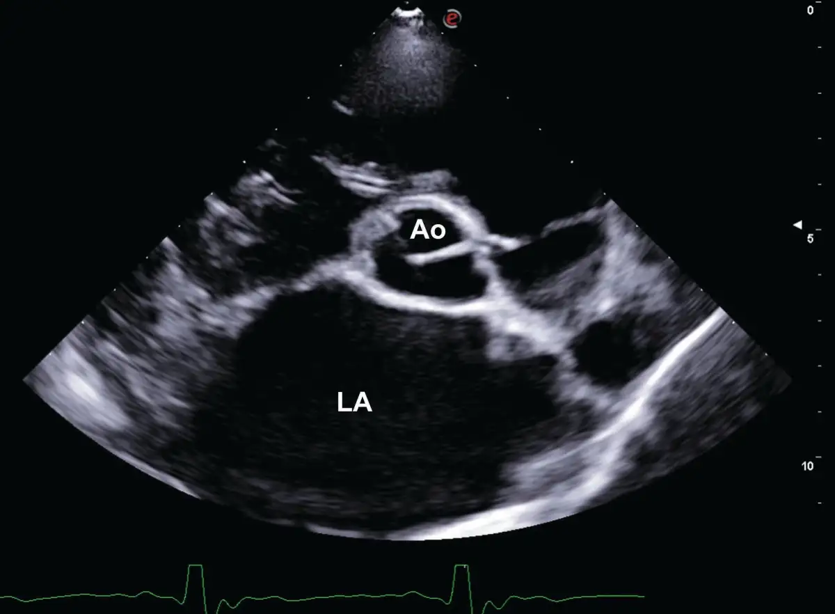 Can human heart failure interventions work in dogs? - 2