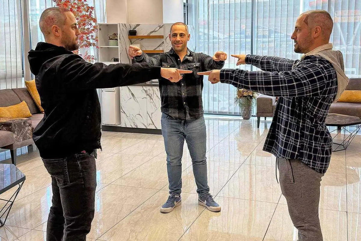 Brothers both find love after undergoing matching hair transplants - 4