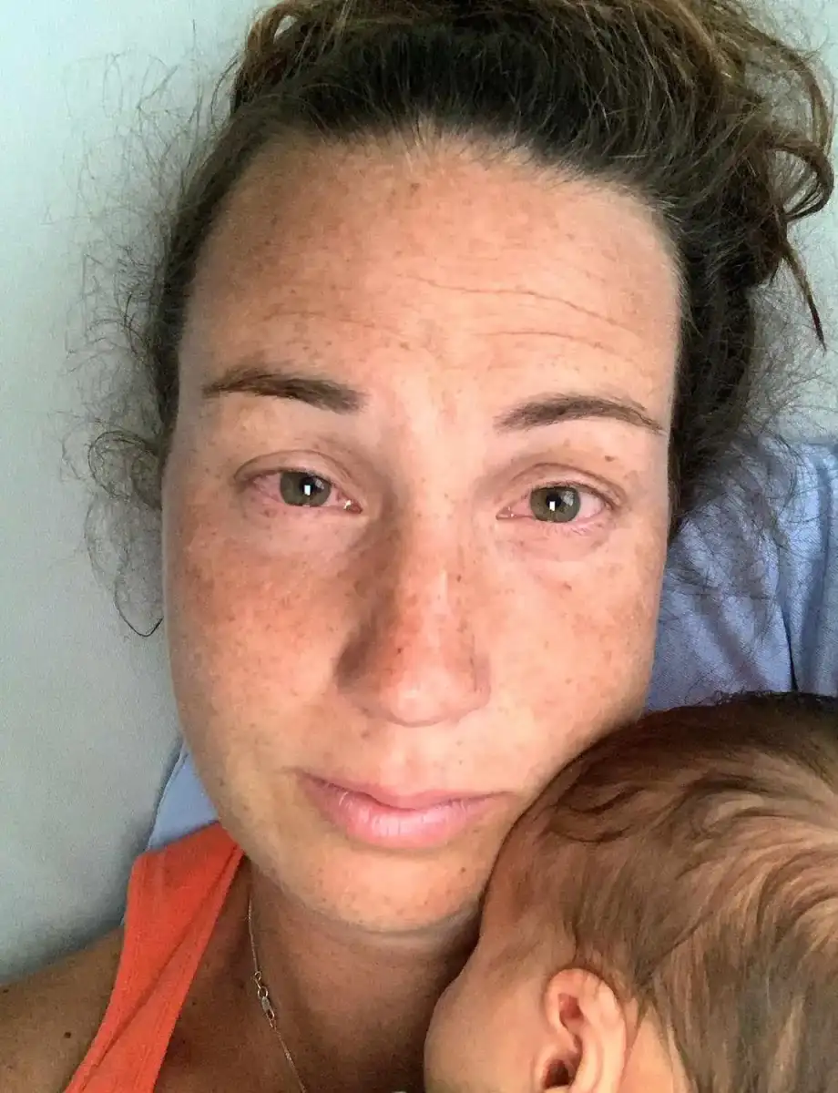 Mother-of-three, 38, diagnosed with rare cancer after begging doctors to investigate 'fatty lump' for TEN years: 'They said it was a harmless lipoma' - 3