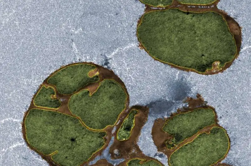 Mysterious acids keep bacteria rod-shaped by restraining rogue enzyme, experiments reveal - 1