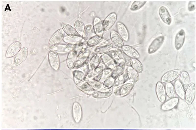 Scientists uncover hidden parasite diversity in barb fish from the Sea of Galilee - 2