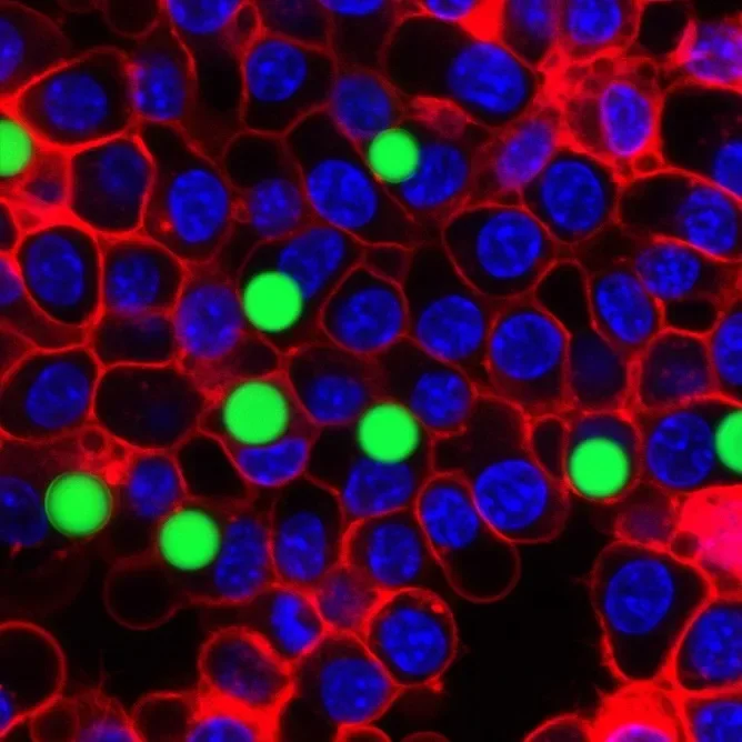 Tiny flexible lasers enable force sensing inside living cells - 1