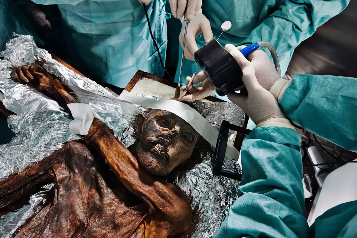 Ötzi the Iceman and his microbiome—a 5,300-year-old relationship - 2