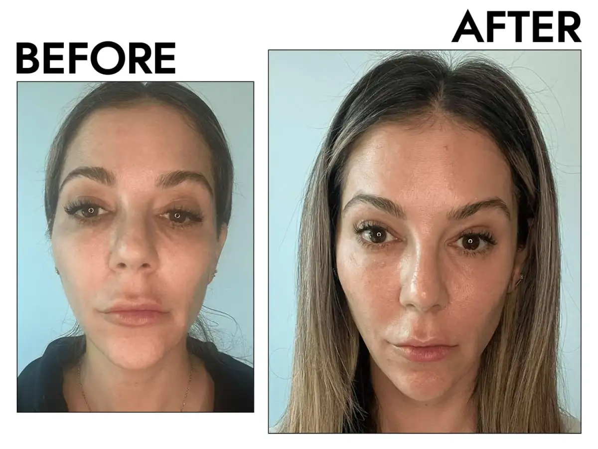 What anti-aging hyaluronic acid is the best? I put 5 drugstore serums to the test — this was my favourite - 1