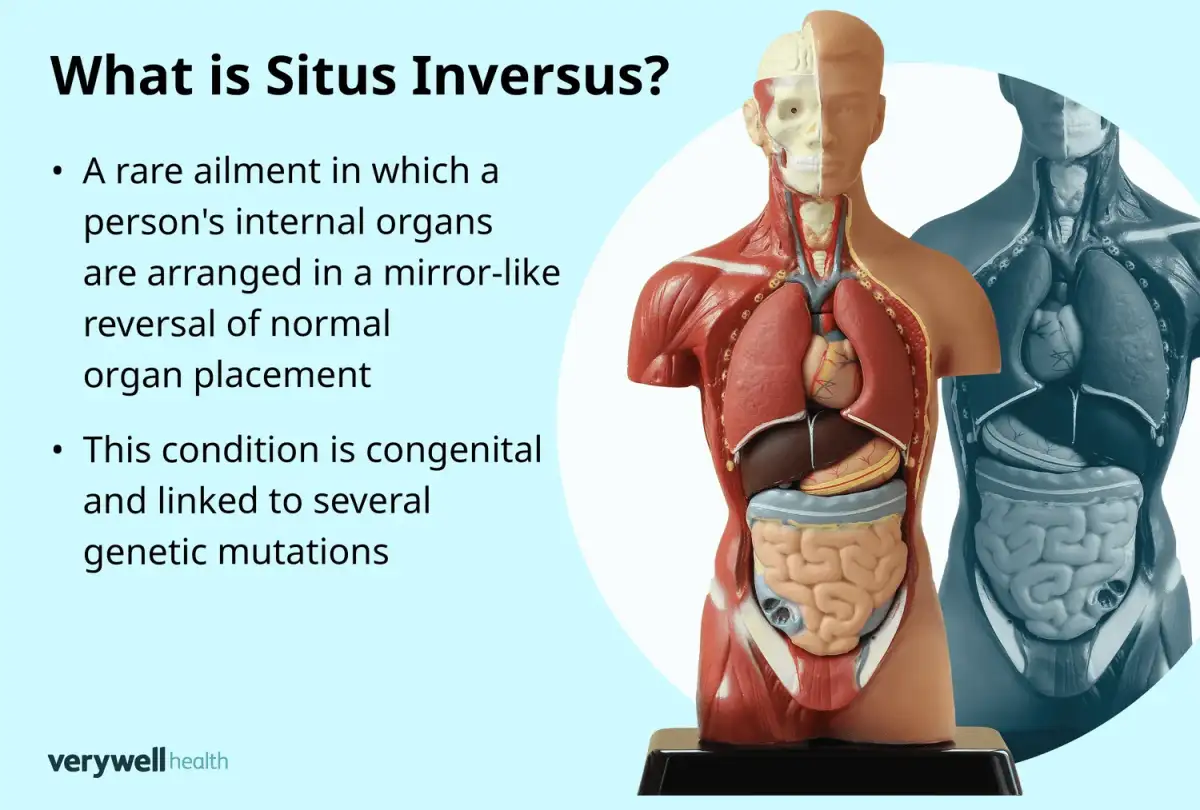 "He Has Situs Inversus, A Rare Condition Where His Organs Are Reversed": 28 Interesting Facts About The NBA And Its Players - 1